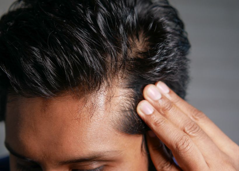 Men's Hair Thinning: Early Signs & Solutions
